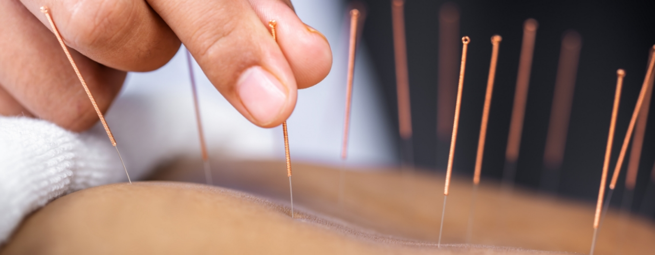 acupuncture-the-sports-clinic-physiotherapy-oakville-on